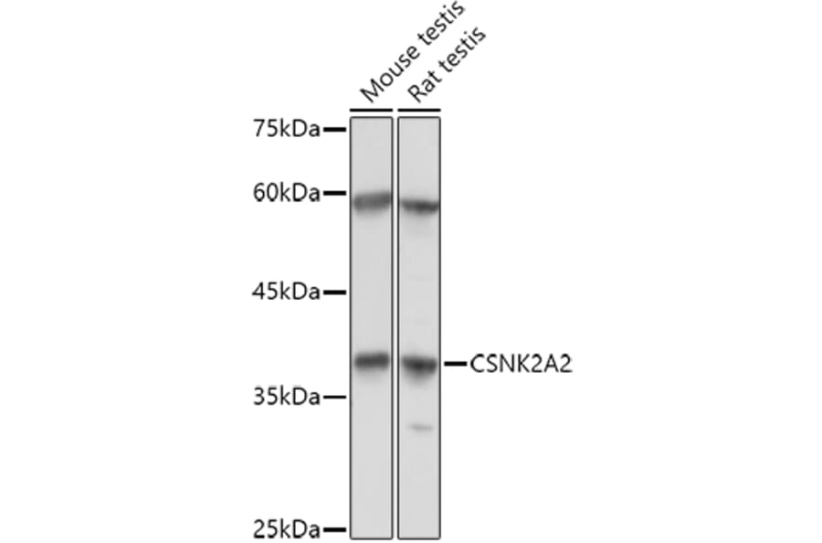 Western Blot - Anti-CSNK2A2 Antibody (A13551) - Antibodies.com