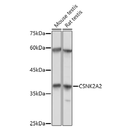 Western Blot - Anti-CSNK2A2 Antibody (A13551) - Antibodies.com