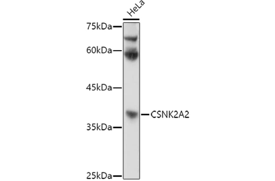 Western Blot - Anti-CSNK2A2 Antibody (A13551) - Antibodies.com