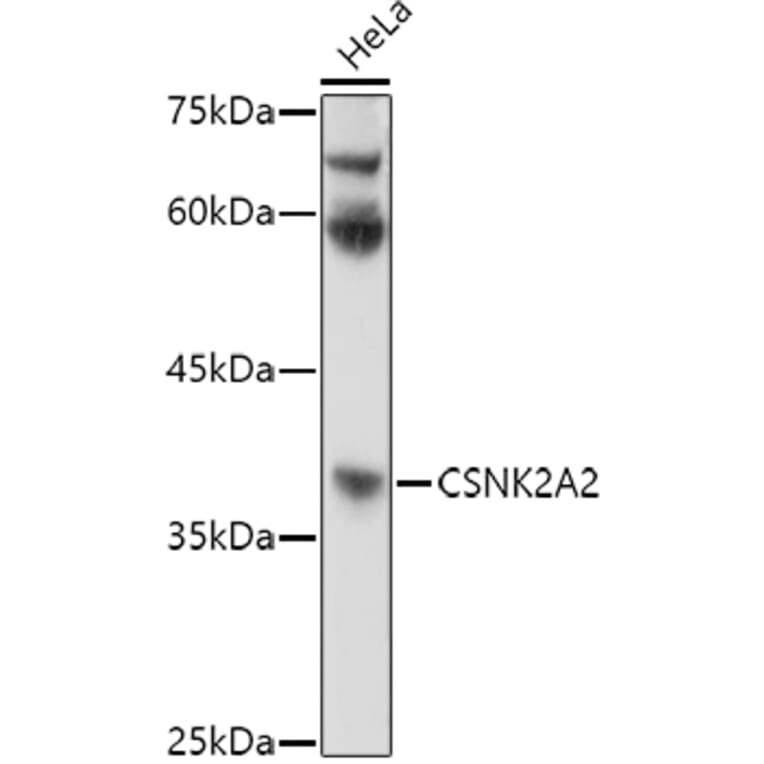 Western Blot - Anti-CSNK2A2 Antibody (A13551) - Antibodies.com