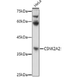 Western Blot - Anti-CSNK2A2 Antibody (A13551) - Antibodies.com