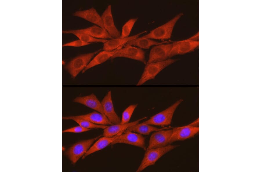 Immunofluorescence - Anti-CSNK2A2 Antibody (A13551) - Antibodies.com