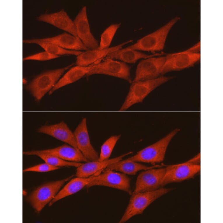 Immunofluorescence - Anti-CSNK2A2 Antibody (A13551) - Antibodies.com