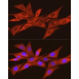 Immunofluorescence - Anti-CSNK2A2 Antibody (A13551) - Antibodies.com