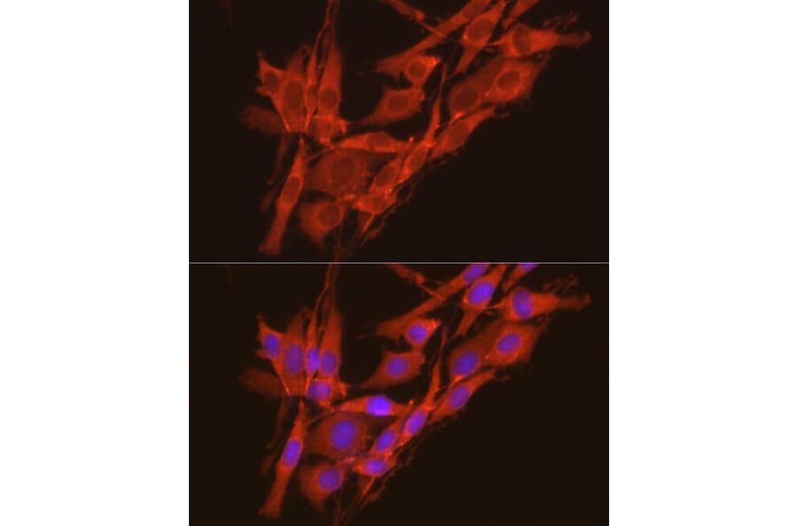 Immunofluorescence - Anti-CSNK2A2 Antibody (A13551) - Antibodies.com