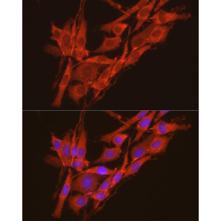 Immunofluorescence - Anti-CSNK2A2 Antibody (A13551) - Antibodies.com