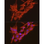 Immunofluorescence - Anti-CSNK2A2 Antibody (A13551) - Antibodies.com