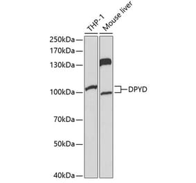 Western Blot - Anti-DPD Antibody (A13552) - Antibodies.com