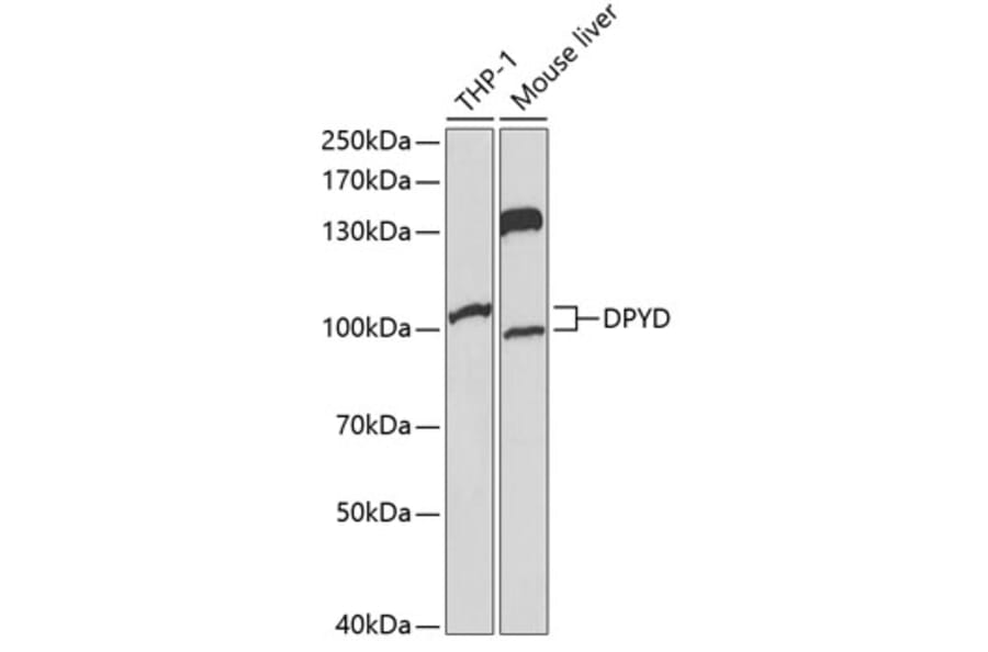 Western Blot - Anti-DPD Antibody (A13552) - Antibodies.com