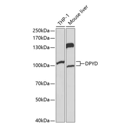 Western Blot - Anti-DPD Antibody (A13552) - Antibodies.com