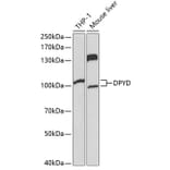 Western Blot - Anti-DPD Antibody (A13552) - Antibodies.com