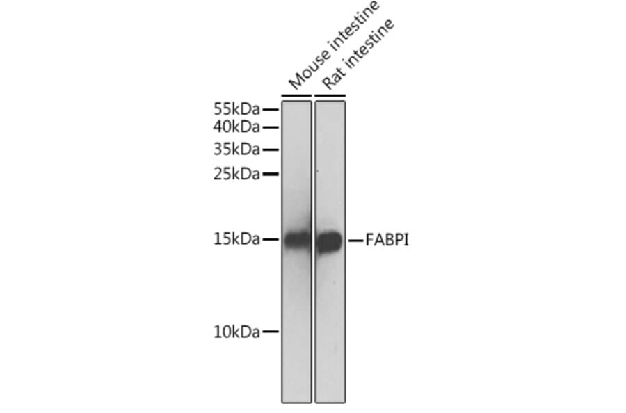 Western Blot - Anti-I-FABP Antibody (A13553) - Antibodies.com