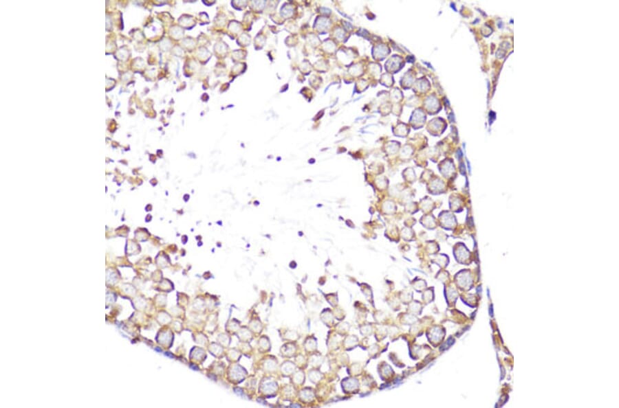 Immunohistochemistry - Anti-CD62L Antibody (A13554) - Antibodies.com