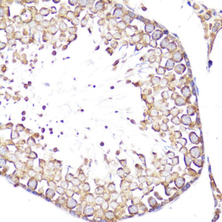 Immunohistochemistry - Anti-CD62L Antibody (A13554) - Antibodies.com