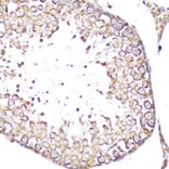 Immunohistochemistry - Anti-CD62L Antibody (A13554) - Antibodies.com