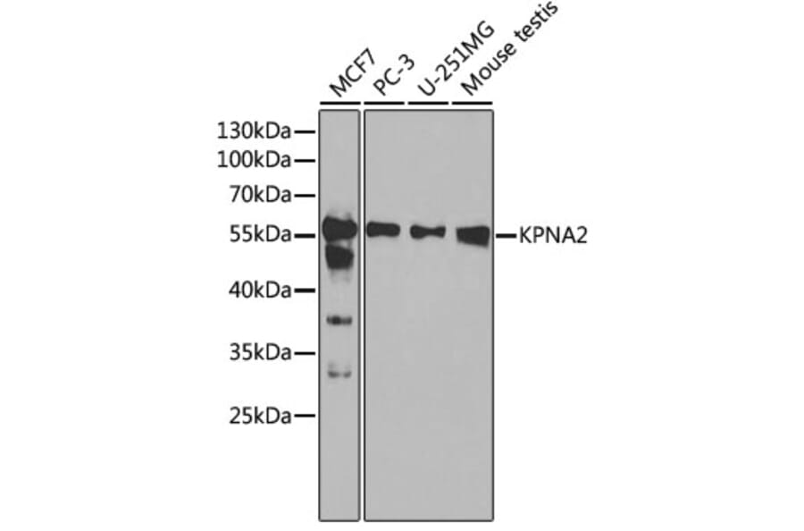 Western Blot - Anti-KPNA2 Antibody (A13555) - Antibodies.com