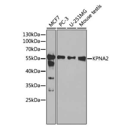 Western Blot - Anti-KPNA2 Antibody (A13555) - Antibodies.com