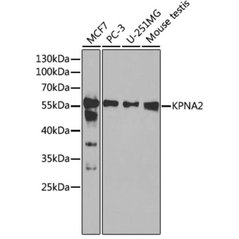 Western Blot - Anti-KPNA2 Antibody (A13555) - Antibodies.com