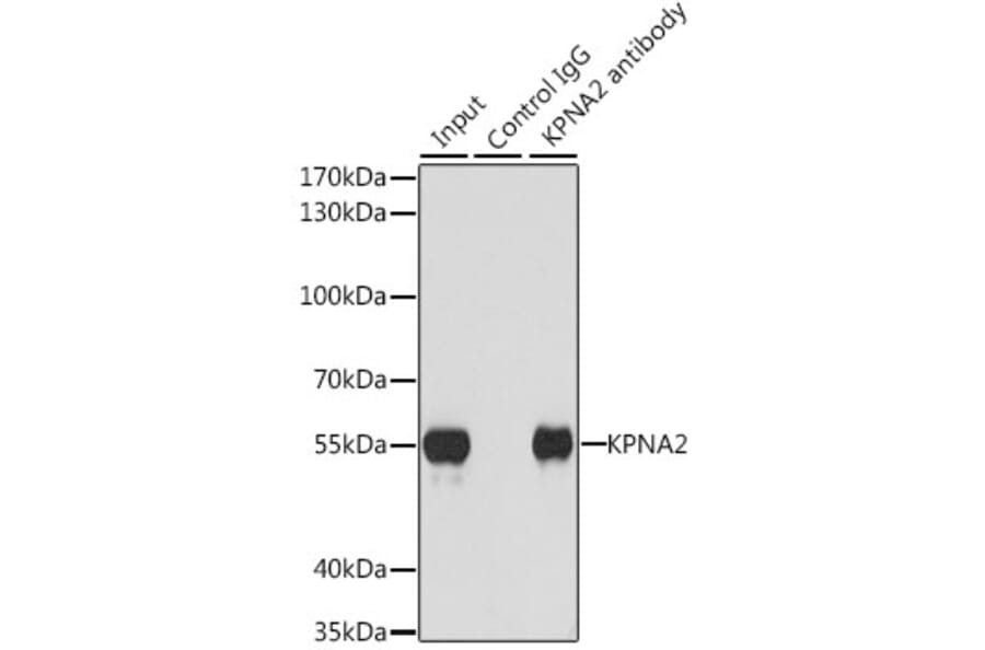 Western Blot - Anti-KPNA2 Antibody (A13555) - Antibodies.com