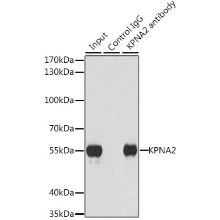 Western Blot - Anti-KPNA2 Antibody (A13555) - Antibodies.com
