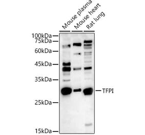 Western Blot - Anti-TFPI Antibody (A13556) - Antibodies.com