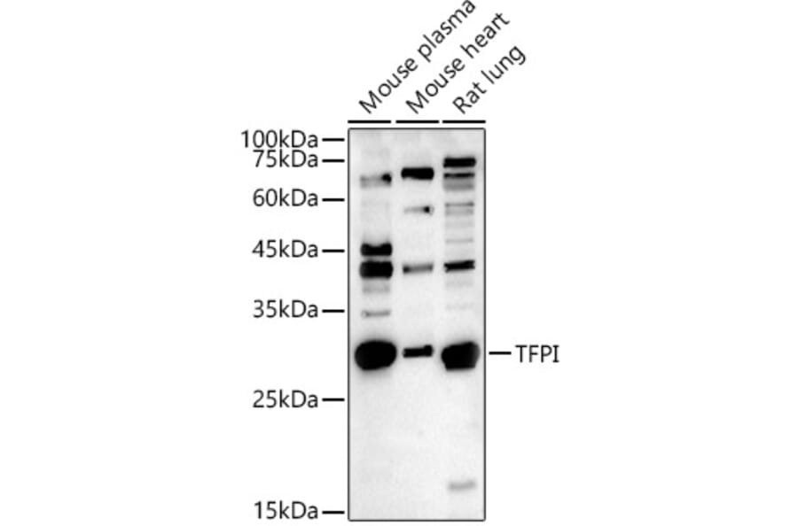 Western Blot - Anti-TFPI Antibody (A13556) - Antibodies.com