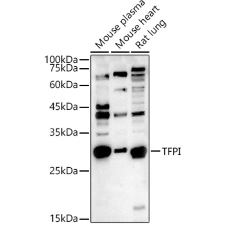 Western Blot - Anti-TFPI Antibody (A13556) - Antibodies.com