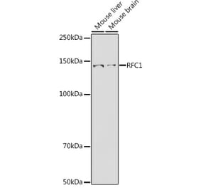 Western Blot - Anti-RFC1 Antibody (A13557) - Antibodies.com