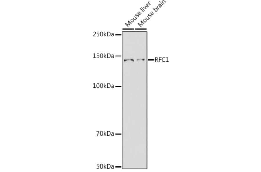 Western Blot - Anti-RFC1 Antibody (A13557) - Antibodies.com