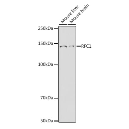 Western Blot - Anti-RFC1 Antibody (A13557) - Antibodies.com