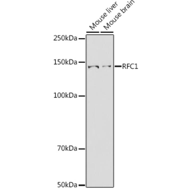 Western Blot - Anti-RFC1 Antibody (A13557) - Antibodies.com