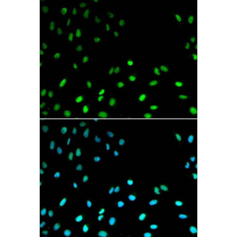 Immunofluorescence - Anti-RFC1 Antibody (A13557) - Antibodies.com