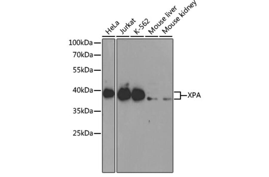 Western Blot - Anti-XPA Antibody (A1626) - Antibodies.com