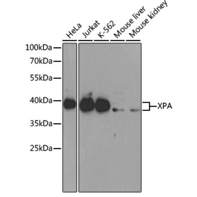 Western Blot - Anti-XPA Antibody (A1626) - Antibodies.com