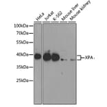 Western Blot - Anti-XPA Antibody (A1626) - Antibodies.com