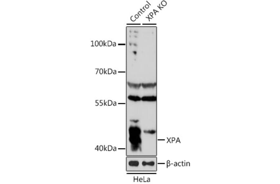 Western Blot - Anti-XPA Antibody (A1626) - Antibodies.com