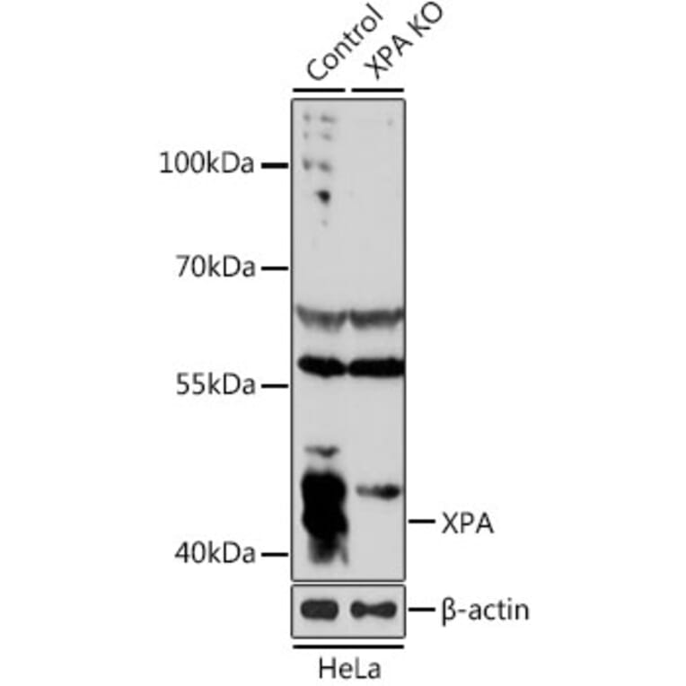 Western Blot - Anti-XPA Antibody (A1626) - Antibodies.com