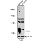 Western Blot - Anti-XPA Antibody (A1626) - Antibodies.com