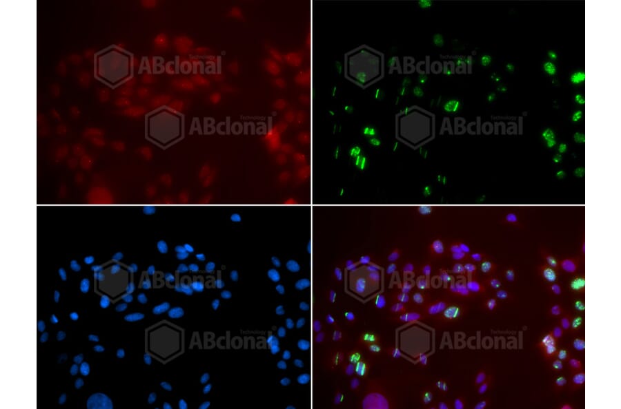 Immunofluorescence - Anti-XPA Antibody (A1626) - Antibodies.com