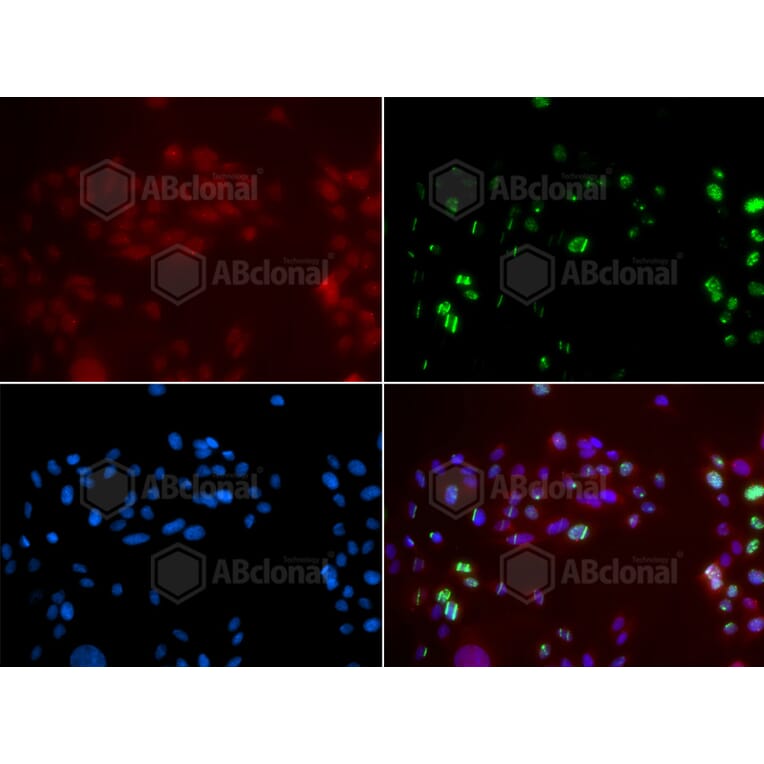 Immunofluorescence - Anti-XPA Antibody (A1626) - Antibodies.com