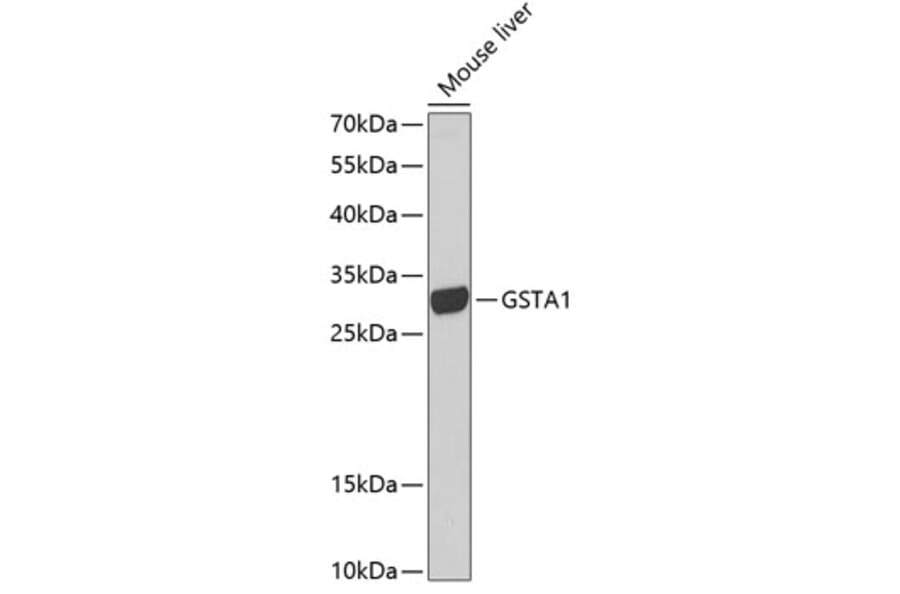 Western Blot - Anti-GSTA1 Antibody (A13559) - Antibodies.com