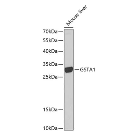 Western Blot - Anti-GSTA1 Antibody (A13559) - Antibodies.com