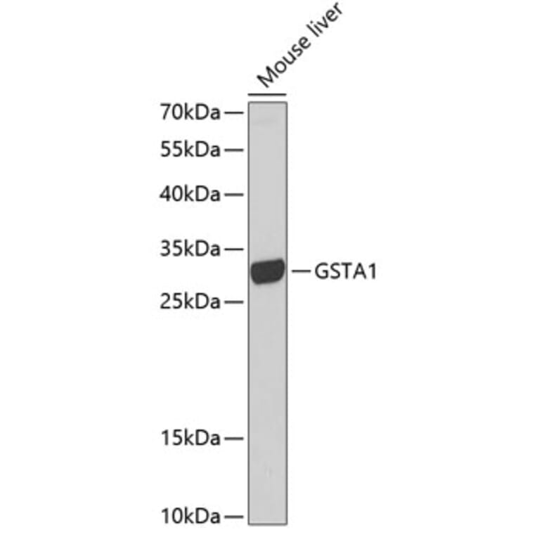 Western Blot - Anti-GSTA1 Antibody (A13559) - Antibodies.com