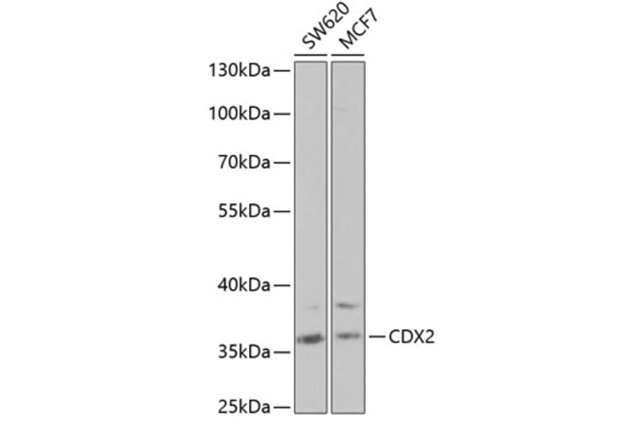 Anti-CDX2 Antibody (A13560) | Antibodies.com