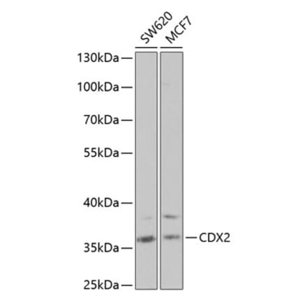 Western Blot - Anti-CDX2 Antibody (A13560) - Antibodies.com