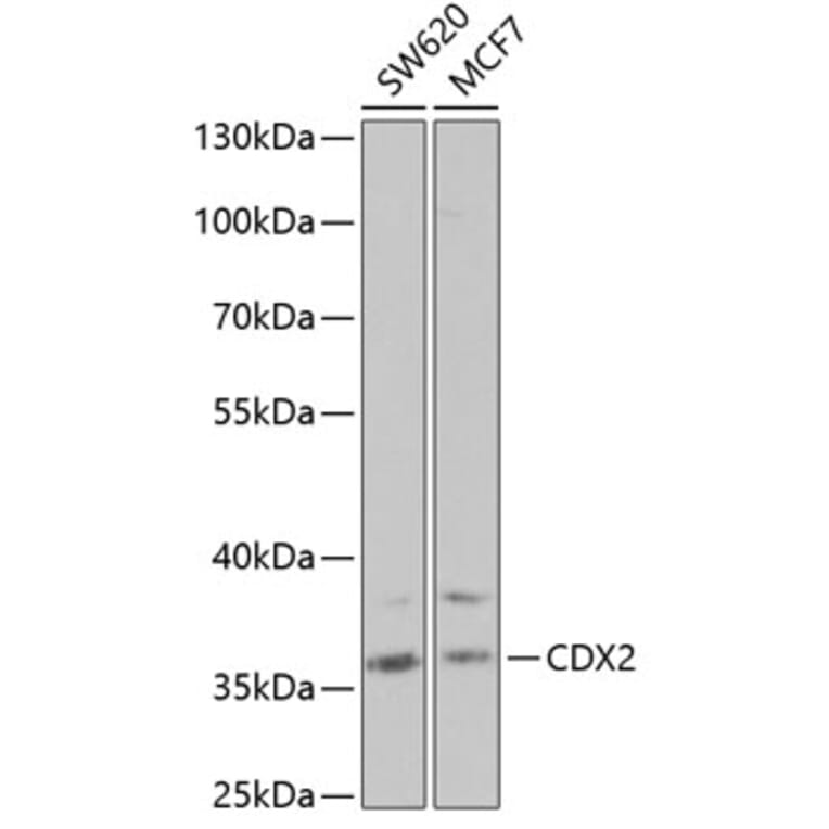 Western Blot - Anti-CDX2 Antibody (A13560) - Antibodies.com