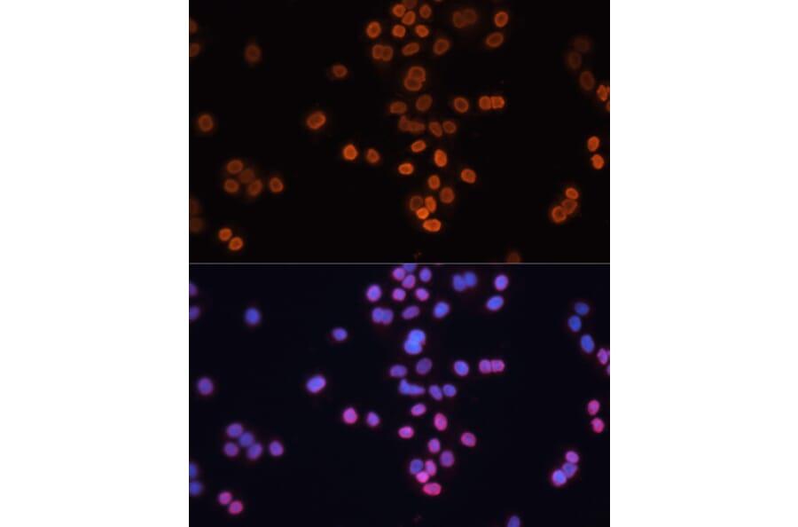 Immunofluorescence - Anti-CDX2 Antibody (A13560) - Antibodies.com
