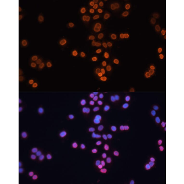 Immunofluorescence - Anti-CDX2 Antibody (A13560) - Antibodies.com