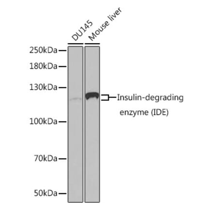 Western Blot - Anti-Insulin degrading enzyme / IDE Antibody (A13561) - Antibodies.com