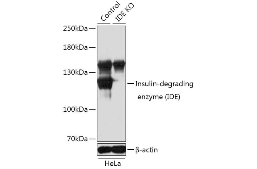 Anti-Insulin degrading enzyme / IDE Antibody (A13561)